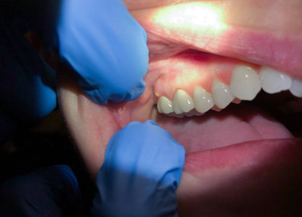 Best Mobile Emergency Dentist in Grandwood Park, IL