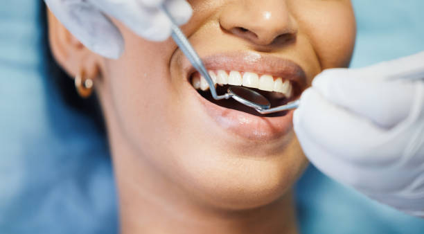 Best Emergency Root Canal Treatment in Grandwood Park, IL