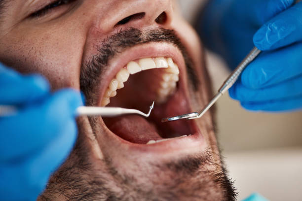 Best Emergency Dentist for Lost Fillings or Crowns in Grandwood Park, IL