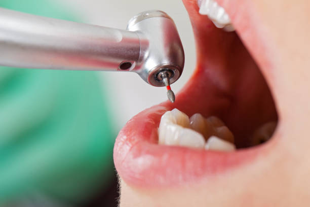Best Broken or Cracked Tooth Emergency Dentist in Grandwood Park, IL